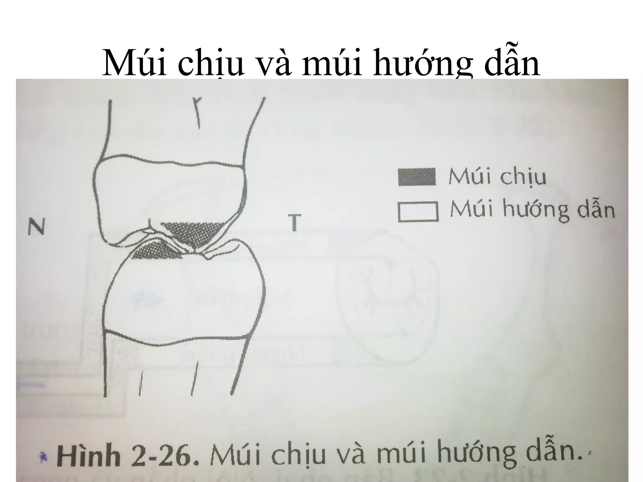 Múi chịu và múi hướng dẫn
 