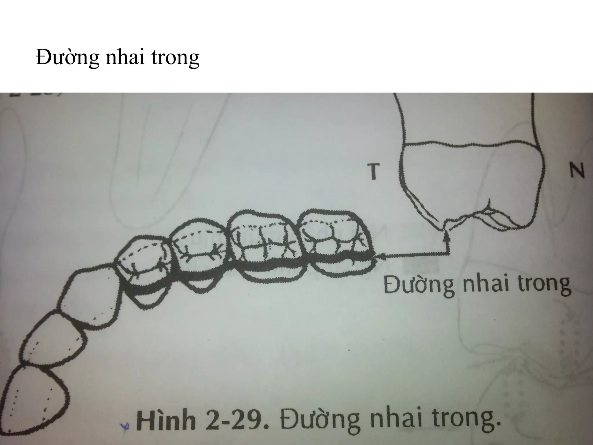 Đường nhai trong
 