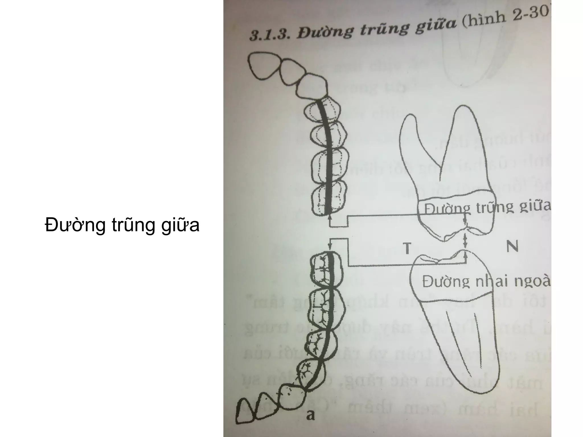 Đường trũng giữa
 