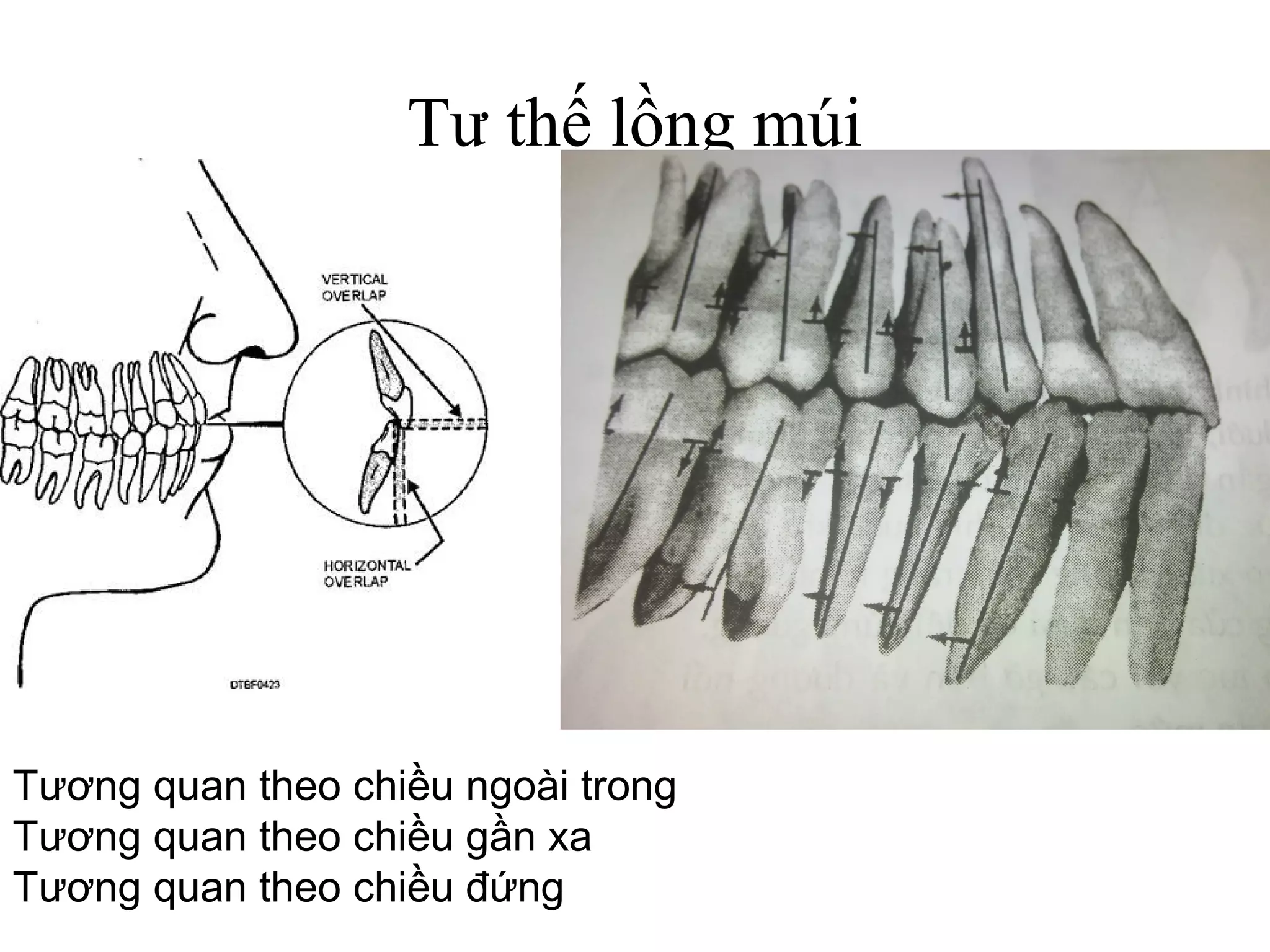 Tư thế lồng múi




Tương quan theo chiều ngoài trong
Tương quan theo chiều gần xa
Tương quan theo chiều đứng
 