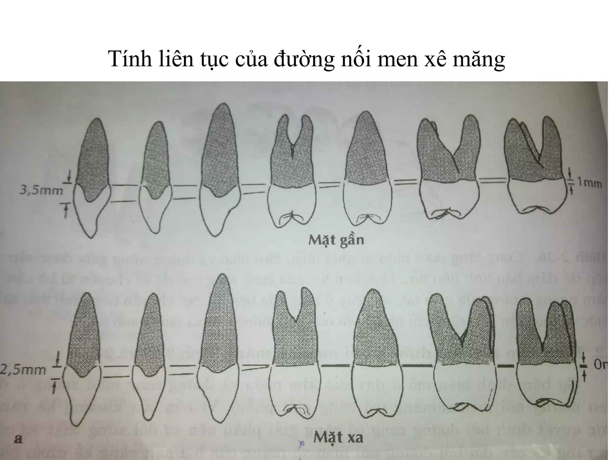Tính liên tục của đường nối men xê măng
 