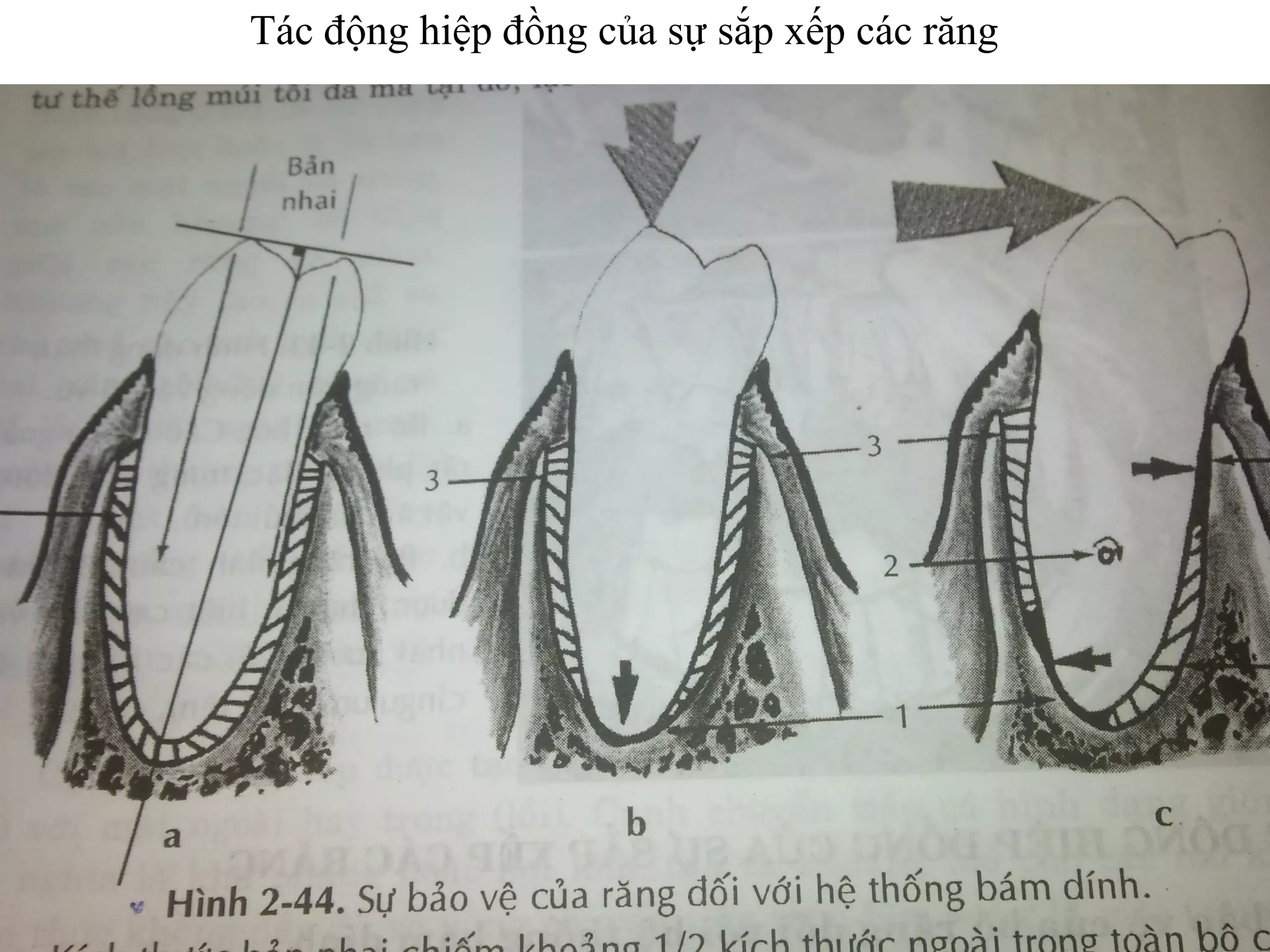 Tác động hiệp đồng của sự sắp xếp các răng
 