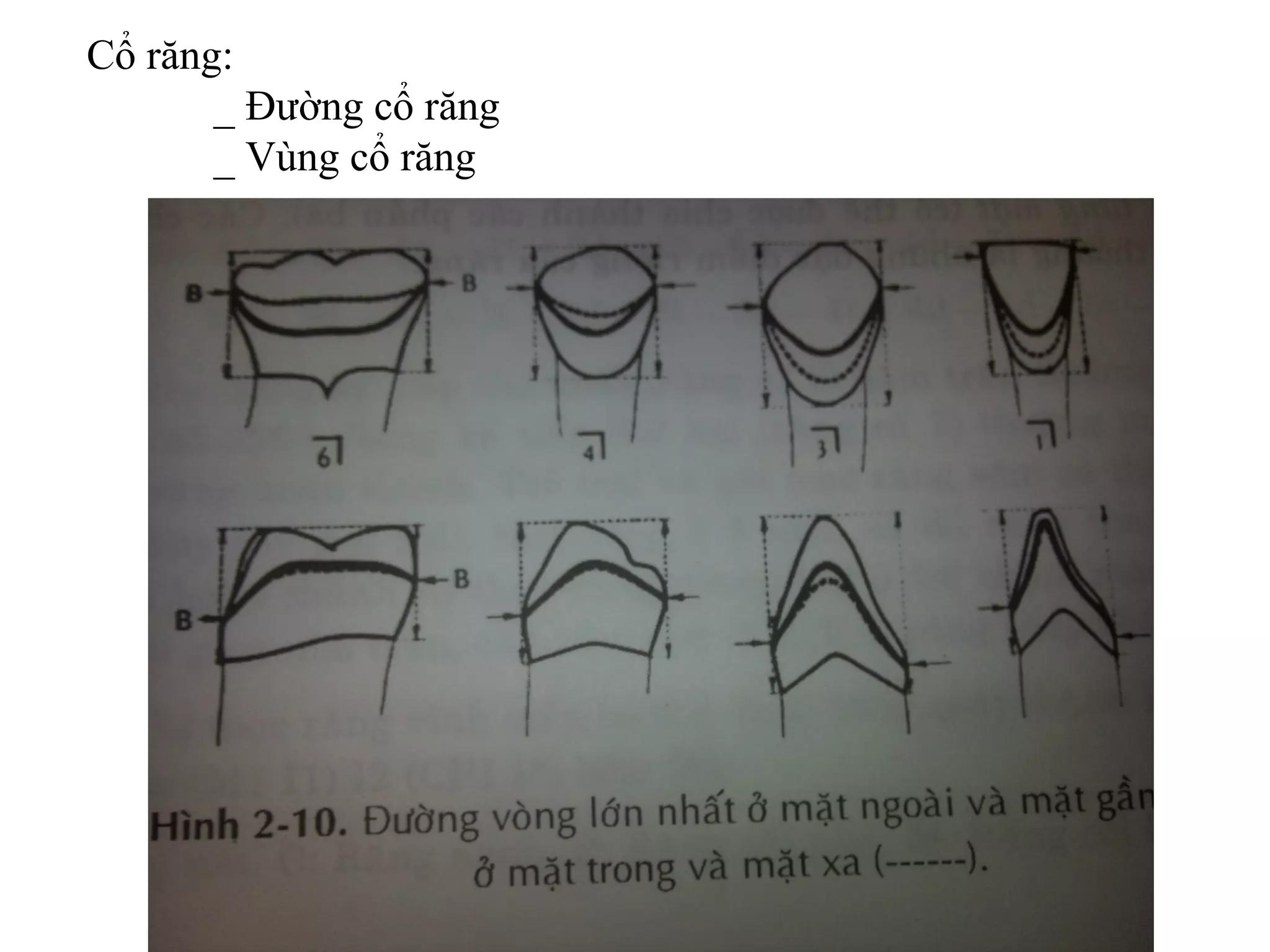 Cổ răng:
       _ Đường cổ răng
       _ Vùng cổ răng
 