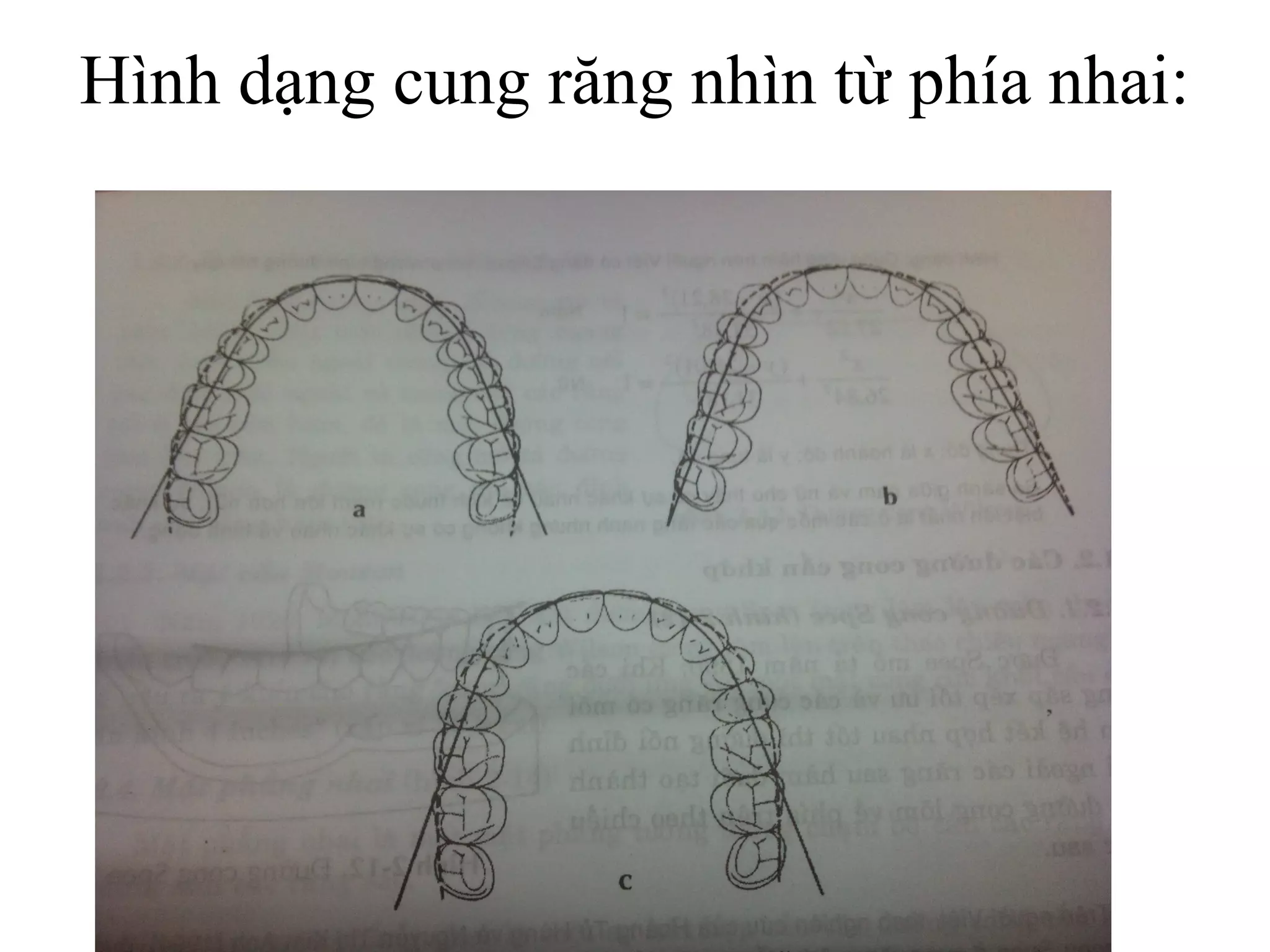 Hình dạng cung răng nhìn từ phía nhai:
 