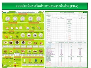 แบบประเมินการรับประทานอาหารอย่างง่าย (EDA)
18
บันทึกและคำนวณ
โดยพยำบำล/นัก
กำหนดอำหำร
 