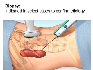 Biopsy:
Indicated in select cases to confirm etiology.
 