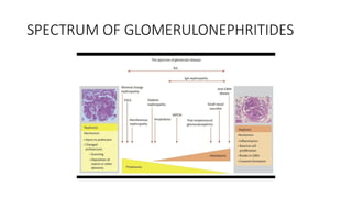 Comprehensive Overview of Glomerulonephritis and Chronic Kidney Disease ...