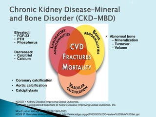 17
Elevated:
• FGF-23
• PTH
• Phosphorus
Decreased:
• Calcitriol
• Calcium
• Coronary calcification
• Aortic calcification
• Calciphylaxis
• Abnormal bone
– Mineralization
– Turnover
– Volume
KDIGO = Kidney Disease: Improving Global Outcomes.
KDIGO® is a registered trademark of Kidney Disease: Improving Global Outcomes, Inc.
Moe S, et al. Kidney Int. 2006;69:1945-1953.
KDIGO® Overview slide presentation at: http://www.kdigo.org/pdf/KDIGO%20Overview%20Slide%20Set.ppt
 