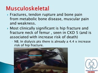  Fractures, tendon rupture and bone pain
from metabolic bone disease, muscular pain
and weakness.
 Most clinically significant is hip fracture and
fracture neck of femur , seen in CKD 5 (and is
associated with increase risk of death)
◦ NB. In dialysis pts there is already a 4.4 x increase
risk of hip fracture.
 