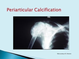 Slide courtesy of D. Sherrard.
 