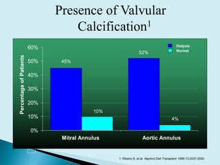 1. Ribeiro S, et al. Nephrol Dial Transplant. 1998;13:2037-2040.
Presence of Valvular
Calcification1
0%
10%
20%
30%
40%
50%
60%
PercentageofPatients
Dialysis
Normal
Mitral Annulus Aortic Annulus
45%
10%
52%
4%
 