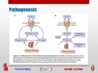 Pathogenesis
Waleed El-Refaey CKD-MBD 21/2/2016
 