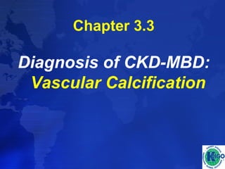 Chapter 3.3 
Diagnosis of CKD-MBD: 
Vascular Calcification 
 