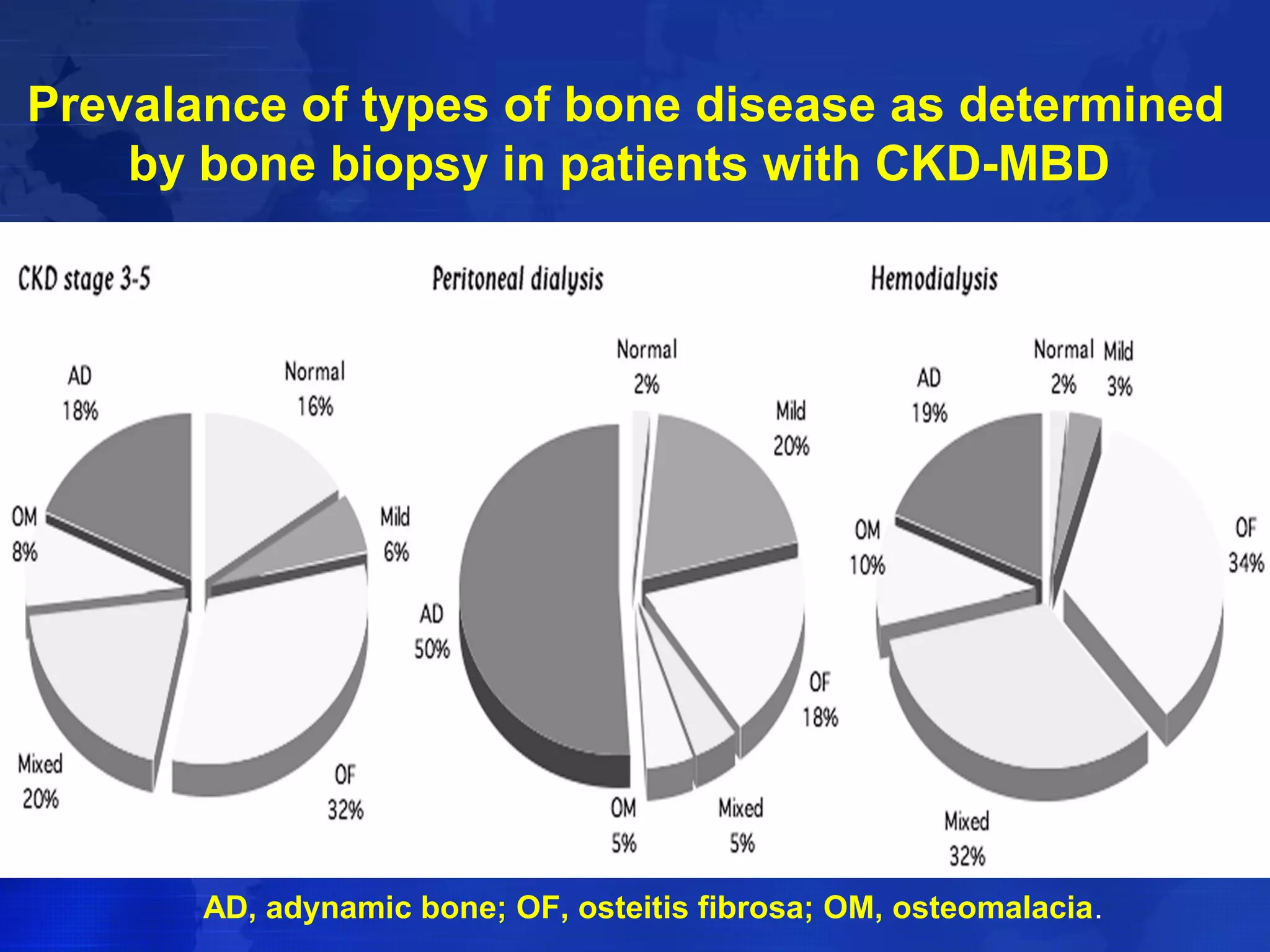 Prevalance of types of bone disease as determined 
by bone biopsy in patients with CKD-MBD 
AD, adynamic bone; OF, osteitis fibrosa; OM, osteomalacia. 
 