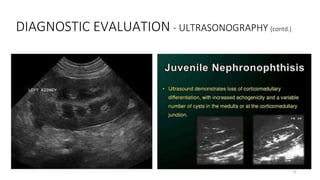 DIAGNOSTIC EVALUATION - ULTRASONOGRAPHY (contd.)
31
 