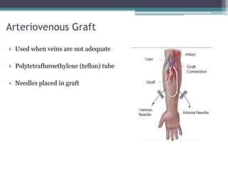 Arteriovenous Graft
• Used when veins are not adequate
• Polytetrafluroethylene (teflon) tube
• Needles placed in graft
 