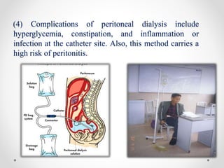 (4) Complications of peritoneal dialysis include
hyperglycemia, constipation, and inflammation or
infection at the catheter site. Also, this method carries a
high risk of peritonitis.
 