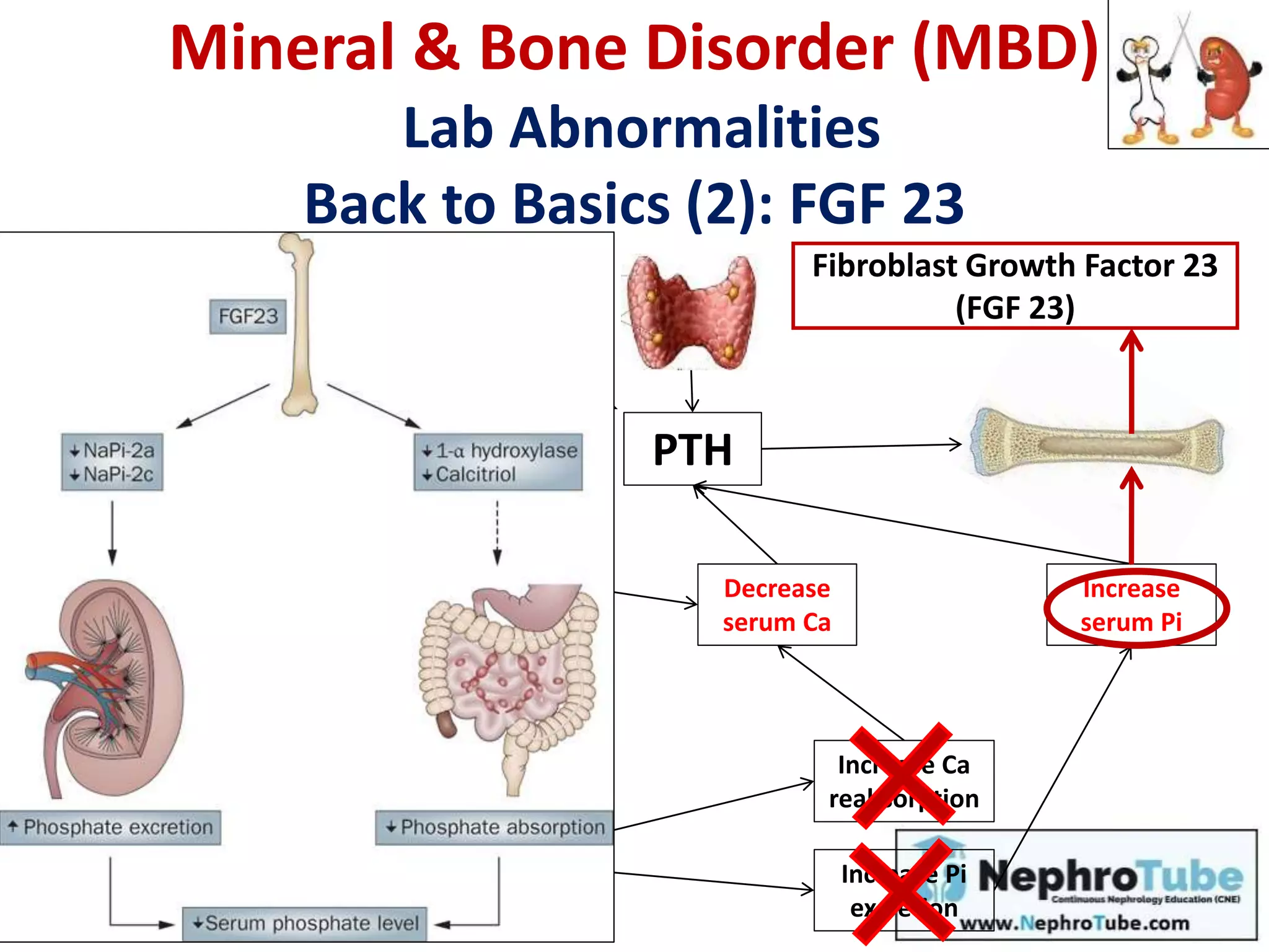 Decrease
serum Ca
Increase
serum Pi
Increase Ca
reabsorption
PTH
Increase Pi
excretion
Vit D
Calcidiol
25-OH-D
Calcitriol
1,25-(OH)2-D
α1 hydroxylase
Fibroblast Growth Factor 23
(FGF 23)
Mineral & Bone Disorder (MBD)
Lab Abnormalities
Back to Basics (2): FGF 23
2ry hyperPTH
 