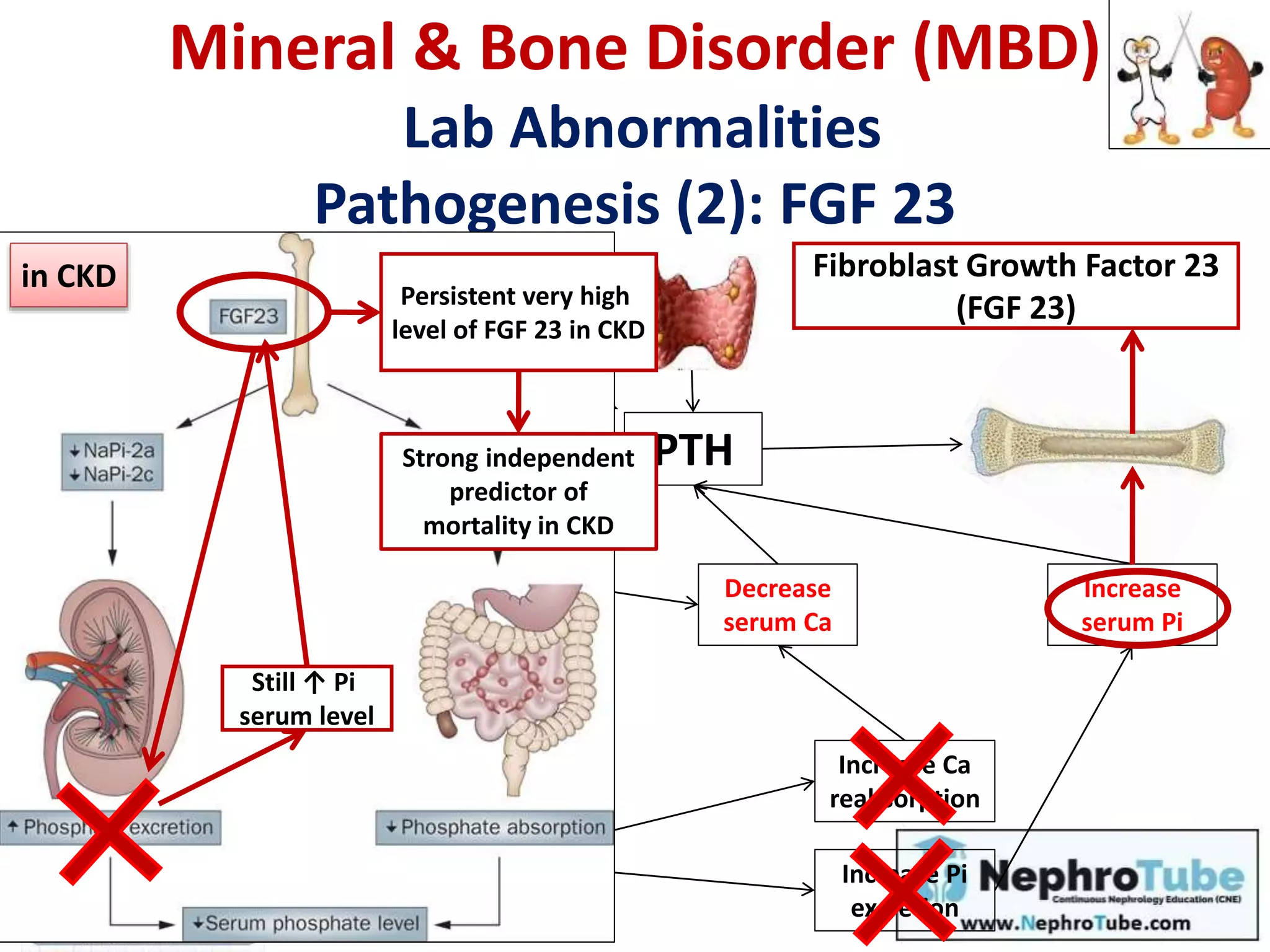 Decrease
serum Ca
Increase
serum Pi
Increase Ca
reabsorption
PTH
Increase Pi
excretion
Vit D
Calcidiol
25-OH-D
Calcitriol
1,25-(OH)2-D
α1 hydroxylase
Fibroblast Growth Factor 23
(FGF 23)
Mineral & Bone Disorder (MBD)
Lab Abnormalities
Pathogenesis (2): FGF 23
Still ↑ Pi
serum level
Persistent very high
level of FGF 23 in CKD
Strong independent
predictor of
mortality in CKD
in CKD
 