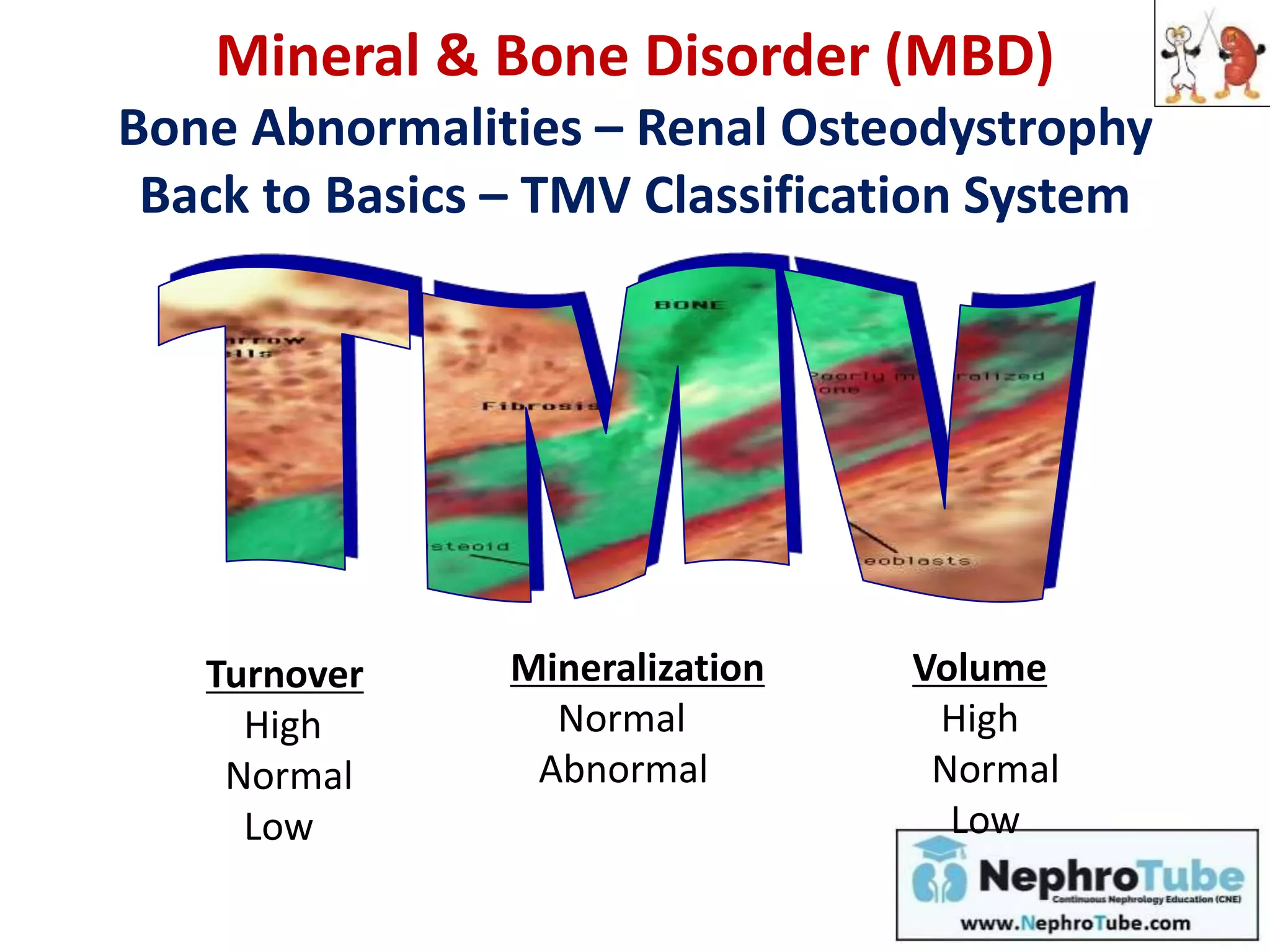 Mineral & Bone Disorder (MBD)
Bone Abnormalities – Renal Osteodystrophy
Back to Basics – TMV Classification System
Turnover
High
Normal
Low
Mineralization
Normal
Abnormal
Volume
High
Normal
Low
 