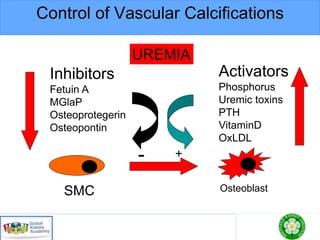 Control of Vascular Calcifications
SMC Osteoblast
Inhibitors
Fetuin A
MGlaP
Osteoprotegerin
Osteopontin
Activators
Phosphorus
Uremic toxins
PTH
VitaminD
OxLDL
- +
UREMIA
 