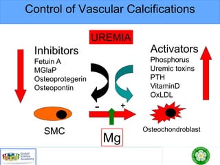 Control of Vascular Calcifications
SMC Osteochondroblast
Inhibitors
Fetuin A
MGlaP
Osteoprotegerin
Osteopontin
Activators
Phosphorus
Uremic toxins
PTH
VitaminD
OxLDL
- +
UREMIA
Mg
 