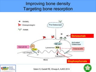 Improving bone density
Targeting bone resorption
Salam S, Eastell RE, Khwaja A, AJKD 2014
Bisphosphonate
Denosumab
 