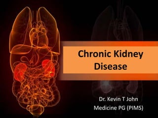Chronic Kidney
Disease
Dr. Kevin T John
Medicine PG (PIMS)
 