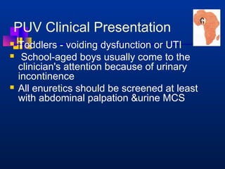 PUV Clinical Presentation 
 Toddlers - voiding dysfunction or UTI 
 School-aged boys usually come to the 
clinician's attention because of urinary 
incontinence 
 All enuretics should be screened at least 
with abdominal palpation urine MCS 
 