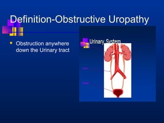 Definition-Obstructive Uropathy 
 Obstruction anywhere 
down the Urinary tract 
 