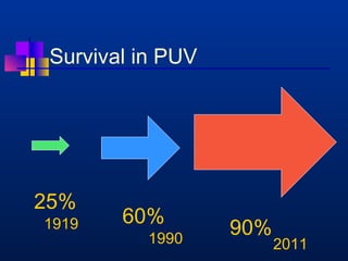 Survival in PUV 
25% 1919 
60% 90% 
1990 2011 
 
