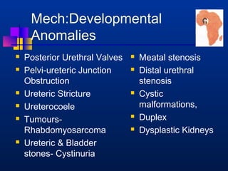 Mech:Developmental 
Anomalies 
 Posterior Urethral Valves 
 Pelvi-ureteric Junction 
Obstruction 
 Ureteric Stricture 
 Ureterocoele 
 Tumours- 
Rhabdomyosarcoma 
 Ureteric  Bladder 
stones- Cystinuria 
 Meatal stenosis 
 Distal urethral 
stenosis 
 Cystic 
malformations, 
 Duplex 
 Dysplastic Kidneys 
 