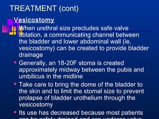TREATMENT (cont) 
Vesicostomy 
 When urethral size precludes safe valve 
ablation, a communicating channel between 
the bladder and lower abdominal wall (ie, 
vesicostomy) can be created to provide bladder 
drainage 
 Generally, an 18-20F stoma is created 
approximately midway between the pubis and 
umbilicus in the midline 
 Take care to bring the dome of the bladder to 
the skin and to limit the stomal size to prevent 
prolapse of bladder urothelium through the 
vesicostomy 
 Its use has decreased because most patients 
can be safely drained and can undergo valve 
 