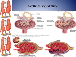 PATHOPHYSIOLOGY
 
