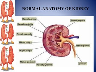 NORMALANATOMY OF KIDNEY
 