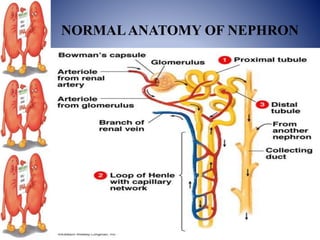 NORMALANATOMY OF NEPHRON
 