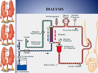 DIALYSIS
 