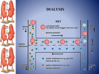DIALYSIS
 