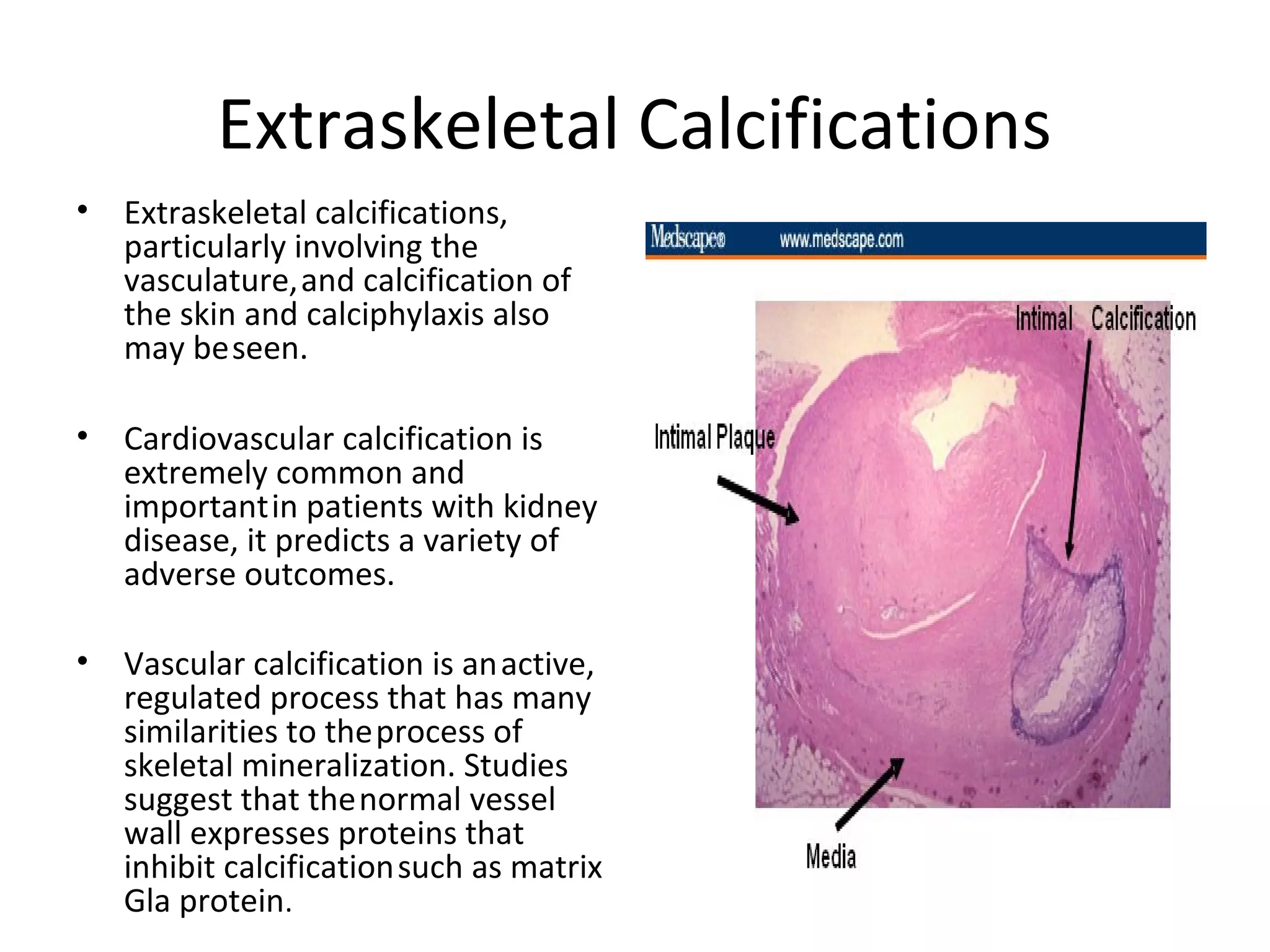 Extraskeletal Calcifications
•   Extraskeletal calcifications,
    particularly involving the
    vasculature, and calcification of
    the skin and calciphylaxis also
    may be seen.

•   Cardiovascular calcification is
    extremely common and
    important in patients with kidney
    disease, it predicts a variety of
    adverse outcomes.

•   Vascular calcification is an active,
    regulated process that has many
    similarities to the process of
    skeletal mineralization. Studies
    suggest that the normal vessel
    wall expresses proteins that
    inhibit calcification such as matrix
    Gla protein.
 