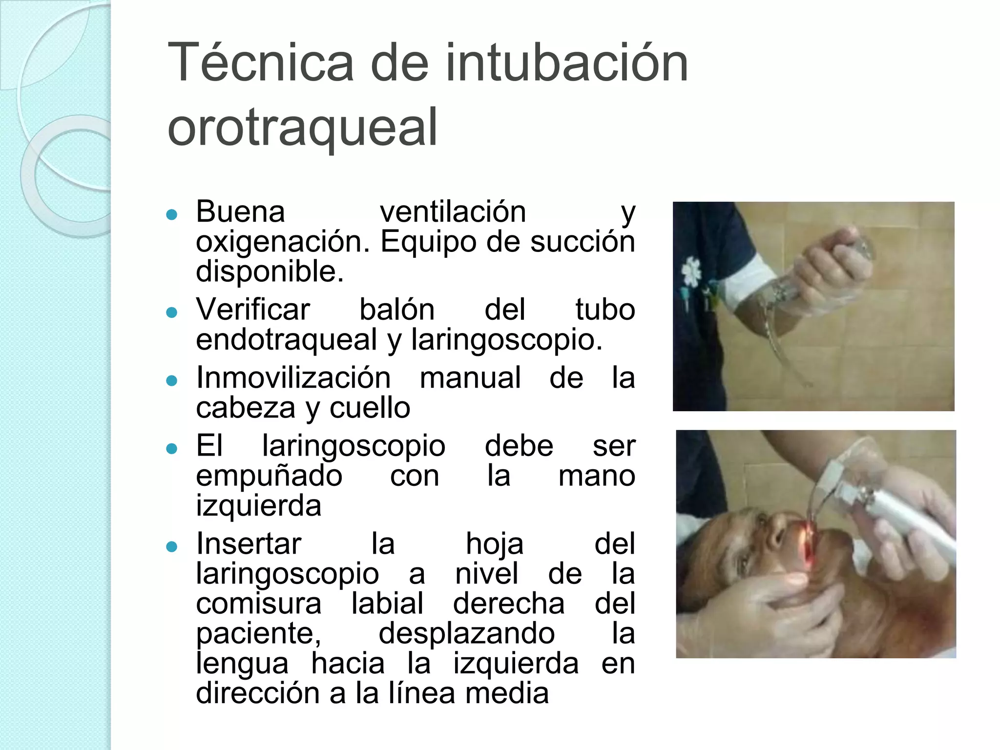 INTUBACIÓN ENDOTRAQUEAL | PPTX