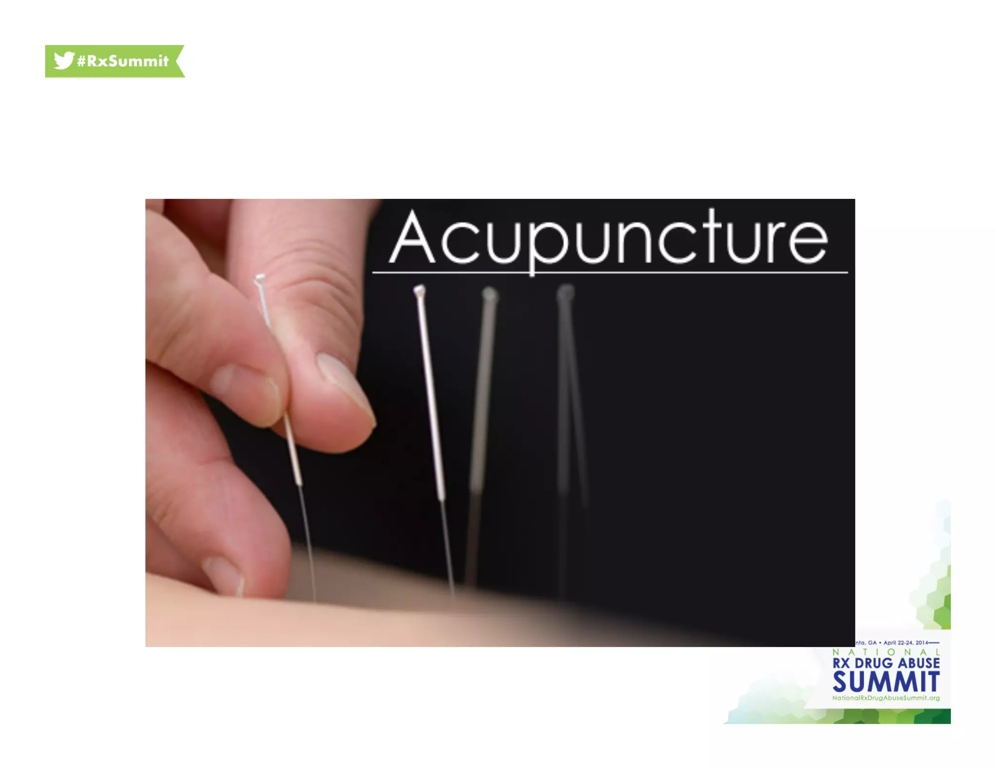 Photo of acupuncture
 