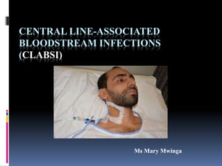 CENTRAL LINE-ASSOCIATED
BLOODSTREAM INFECTIONS
(CLABSI)
Ms Mary Mwinga
 