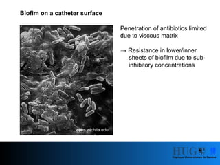 Comprehensive Overview of Central Line-Associated Bloodstream ...