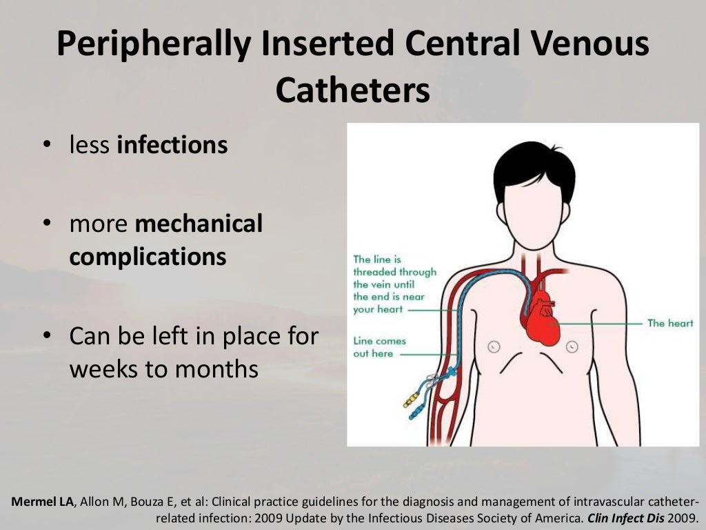 Central Line Associated Blood Stream Infections( CLABSI)