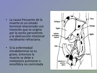 Clace De Ca Ovario 2