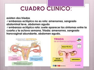 CUADRO CLINICO:
existen dos triadas
✓embarazo ectópico no es roto: amenorrea, sangrado
abdominal leve, abdomen agudo
✓embarazo ectópico roto: suele aparecer los síntomas entre la
cuarta y la octava semana. Triada: amenorrea, sangrado
transvaginal abundante, abdomen agudo.
 