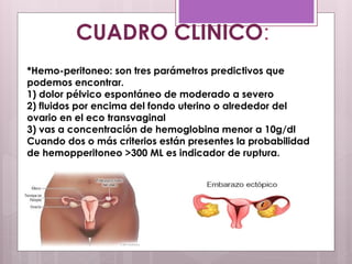 CUADRO CLINICO:
*Hemo-peritoneo: son tres parámetros predictivos que
podemos encontrar.
1) dolor pélvico espontáneo de moderado a severo
2) fluidos por encima del fondo uterino o alrededor del
ovario en el eco transvaginal
3) vas a concentración de hemoglobina menor a 10g/dl
Cuando dos o más criterios están presentes la probabilidad
de hemopperitoneo >300 ML es indicador de ruptura.
 