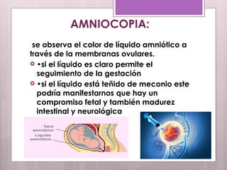 se observa el color de líquido amniótico a
través de la membranas ovulares.
 •si el líquido es claro permite el
seguimiento de la gestación
 •si el líquido está teñido de meconio este
podría manifestarnos que hay un
compromiso fetal y también madurez
intestinal y neurológica
AMNIOCOPIA:
 