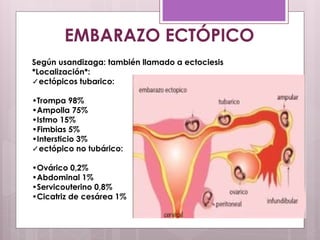 EMBARAZO ECTÓPICO
Según usandizaga: también llamado a ectociesis
*Localización*:
✓ectópicos tubarico:
•Trompa 98%
•Ampolla 75%
•Istmo 15%
•Fimbias 5%
•Intersticio 3%
✓ectópico no tubárico:
•Ovárico 0,2%
•Abdominal 1%
•Servicouterino 0,8%
•Cicatriz de cesárea 1%
 
