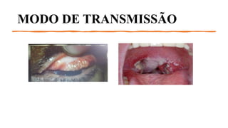 MODO DE TRANSMISSÃO
 